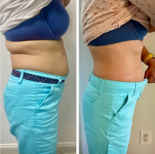 Weight loss before and after